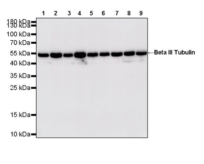 Beta III Tubulin Recombinant Rabbit mAb (S-5529)