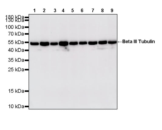 Beta III Tubulin Recombinant Rabbit mAb (S-5529)