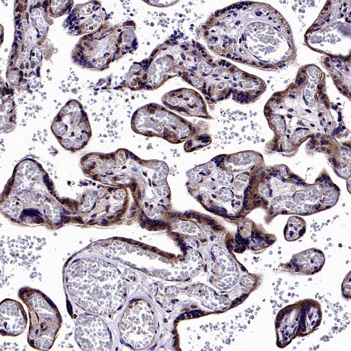 GPD2 Recombinant Rabbit mAb (S-2941-41)