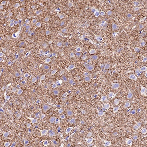 KCC2 Recombinant Rabbit mAb (S-3044-2)