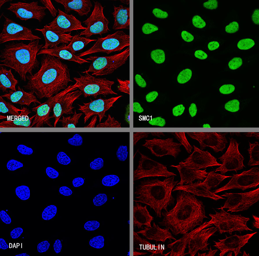 SMC1 Recombinant Rabbit mAb (S-4147-54)