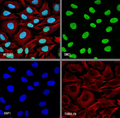 SMC1 Recombinant Rabbit mAb (S-4147-54)