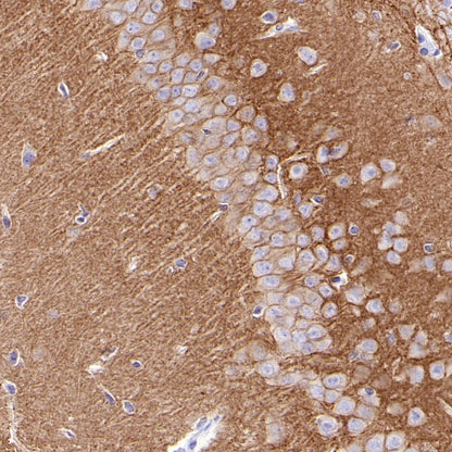 KCC2 Recombinant Rabbit mAb (S-3044-2)