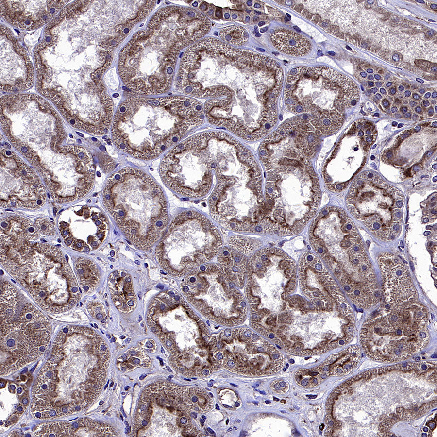 ADAM9 Recombinant Rabbit mAb (S-3270-74)