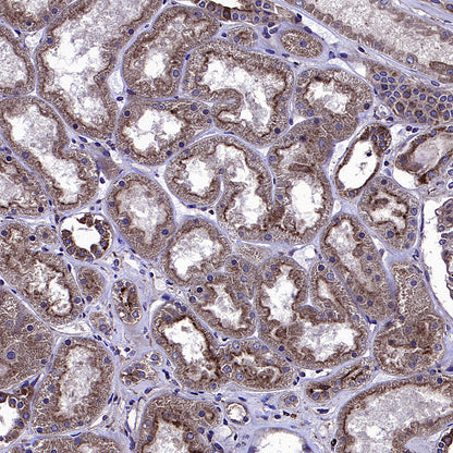 ADAM9 Recombinant Rabbit mAb (S-3270-74)