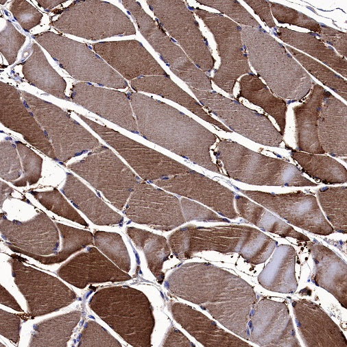 Neuropilin 1 Recombinant Rabbit mAb (S-1453-6)