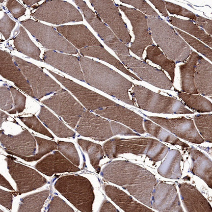 Neuropilin 1 Recombinant Rabbit mAb (S-1453-6)
