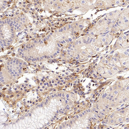 Talin-1 Recombinant Rabbit mAb (S-1483-25)