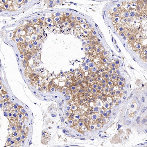 IKK gamma Recombinant Rabbit mAb (S-1359-118)