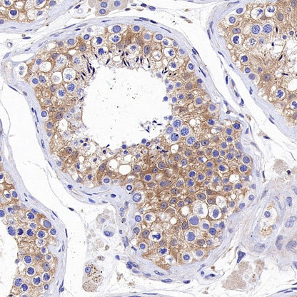 IKK gamma Recombinant Rabbit mAb (S-1359-118)