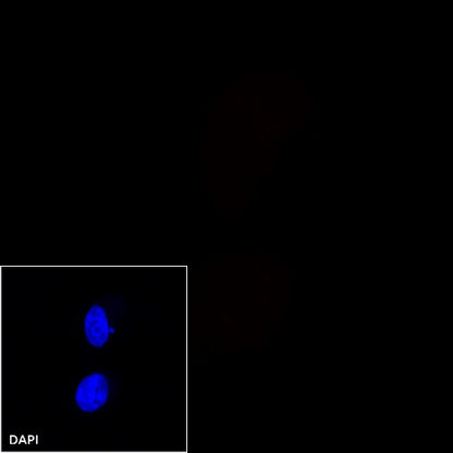 E-Cadherin Recombinant Rabbit mAb (Alexa Fluor® 594 Conjugate) (S-438-5)