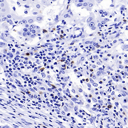 CTLA4 Recombinant Rabbit mAb (SDT-3348)