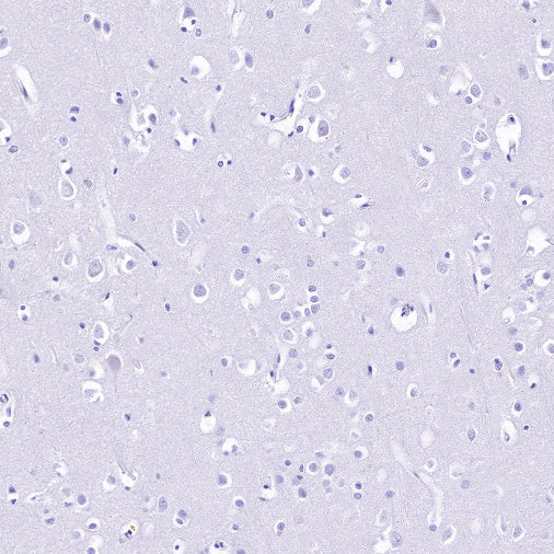 CSF-1R Recombinant Rabbit mAb (S-R219)
