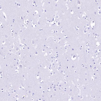 CSF-1R Recombinant Rabbit mAb (S-R219)