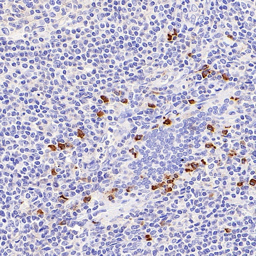 Human IgG F(c) Recombinant Rabbit mAb (S-318-184)