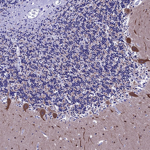 PSD-95 Recombinant Rabbit mAb (S-1518-4)