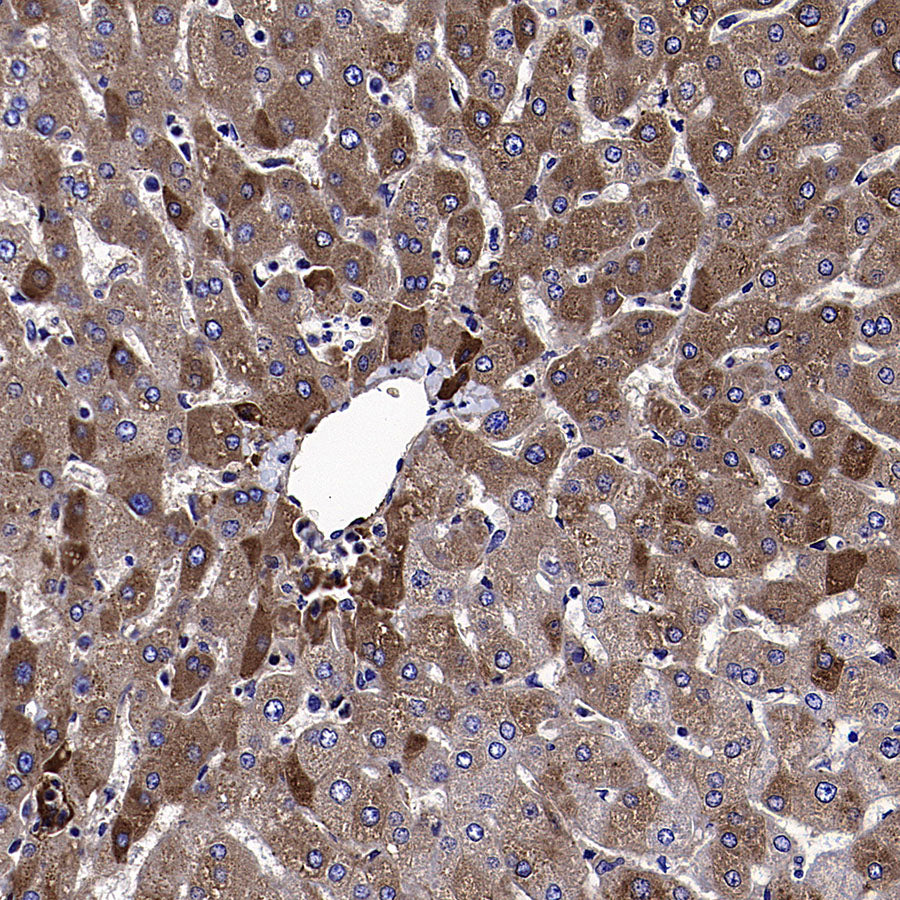 Apolipoprotein CIII Recombinant Rabbit mAb (S-5408)