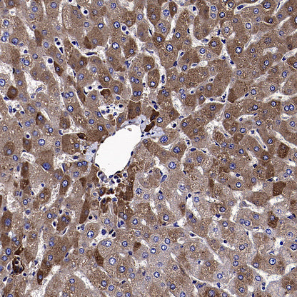 Apolipoprotein CIII Recombinant Rabbit mAb (S-5408)