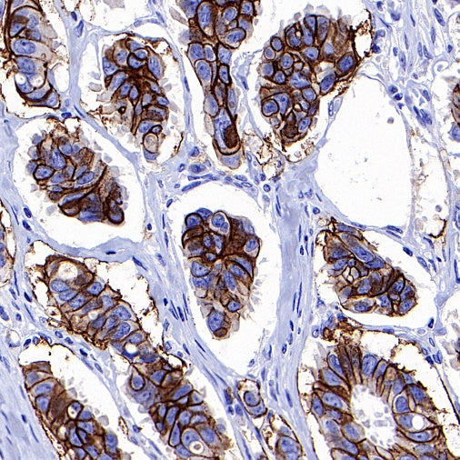 CD44v6 Recombinant Rabbit mAb (S-944-13)