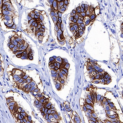 CD44v6 Recombinant Rabbit mAb (S-944-13)