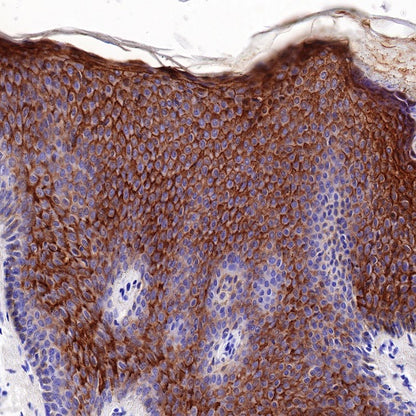 LYPD3/C4.4A Recombinant Rabbit mAb (S-R222)