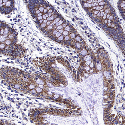 ALDH2 Rabbit Polyclonal Antibody
