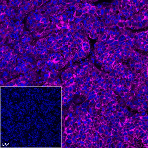 Claudin 1 Recombinant Rabbit mAb (SDT-1289-55)