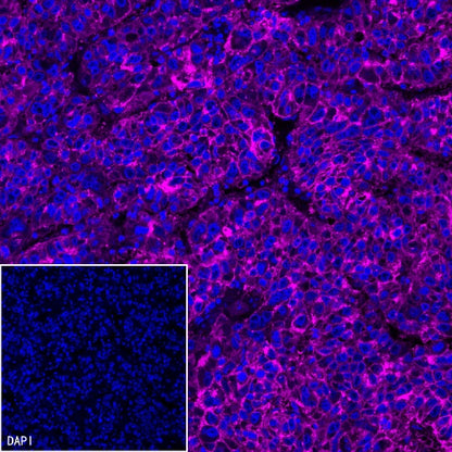 Claudin 1 Recombinant Rabbit mAb (SDT-1289-55)