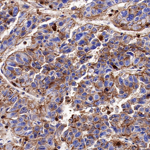 Syntenin Recombinant Rabbit mAb (S-1692-5)
