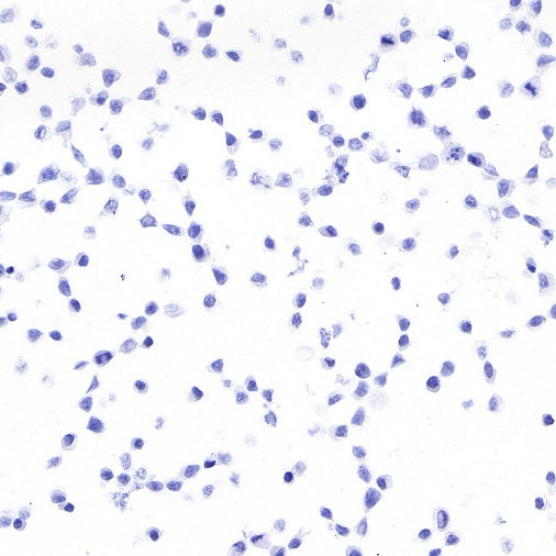 STEAP3 Recombinant Rabbit mAb (S-4466-26)
