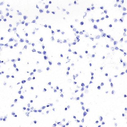 STEAP3 Recombinant Rabbit mAb (S-4466-26)