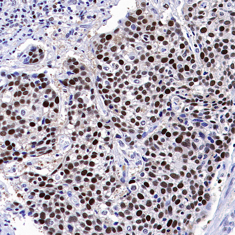 PCNA Recombinant Rabbit mAb (S-5313)
