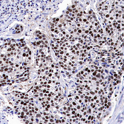 PCNA Recombinant Rabbit mAb (S-5313)