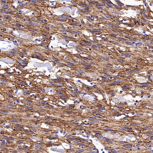 TMEM16A Recombinant Rabbit mAb (SDT-2179-68)