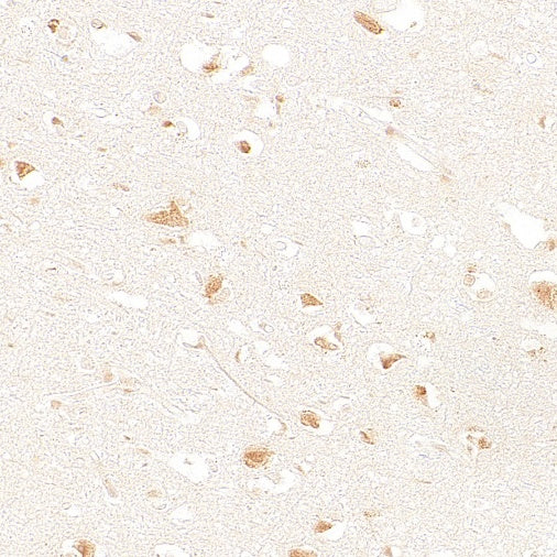 SMN2 Recombinant Rabbit mAb (S-4920-4)