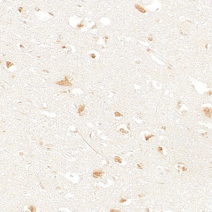 SMN2 Recombinant Rabbit mAb (S-4920-4)