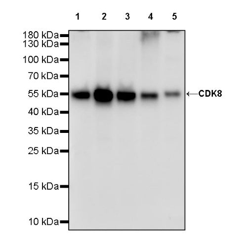 CDK8 Recombinant Rabbit mAb (S-1627-70)