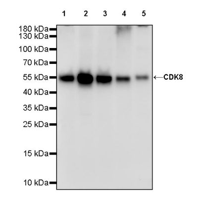 CDK8 Recombinant Rabbit mAb (S-1627-70)