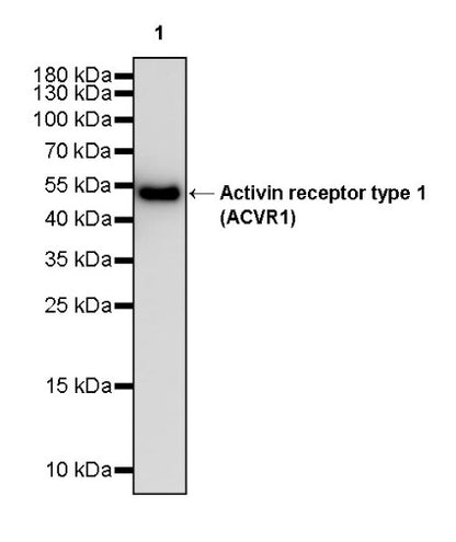 Activin receptor type 1 (ACVR1) Recombinant Rabbit mAb (S-2058-256)