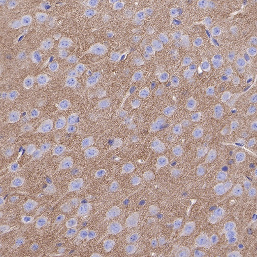 TrkB Recombinant Rabbit mAb (S-488-5)