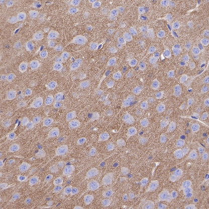 TrkB Recombinant Rabbit mAb (S-488-5)