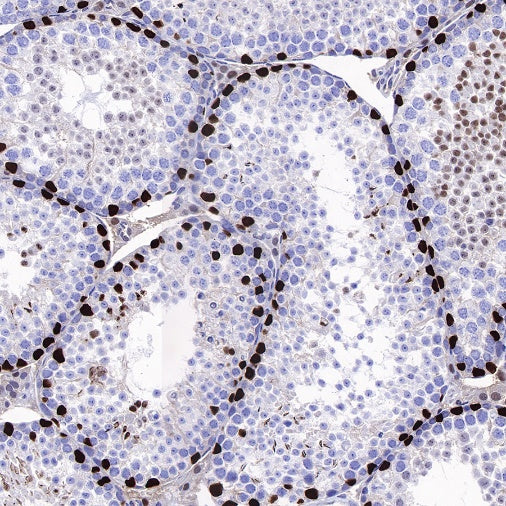 PFKFB3 Recombinant Rabbit mAb (S-653-35)