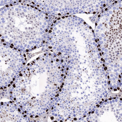 PFKFB3 Recombinant Rabbit mAb (S-653-35)