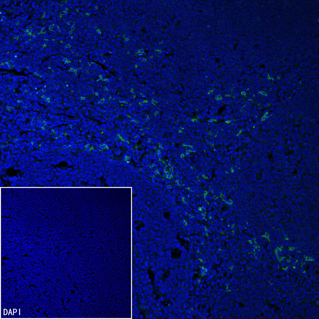 CLEC9A Recombinant Rabbit mAb (S-1904-154)