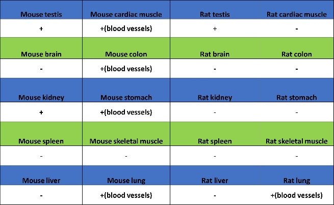 Angiotensin Converting Enzyme 1 Recombinant Rabbit mAb (SDT-2662-122)