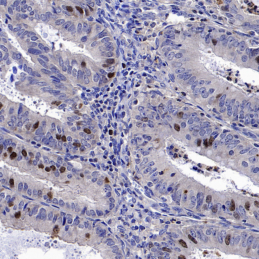 CENP-F Recombinant Rabbit mAb (S-3148-75)