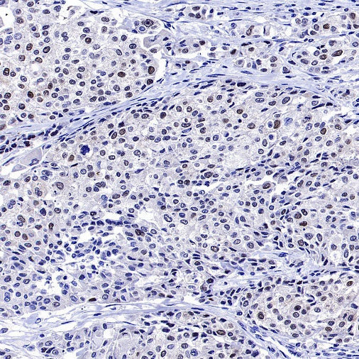 Phospho-NAK/TBK1 (Ser172) Recombinant Rabbit mAb (S-3182)