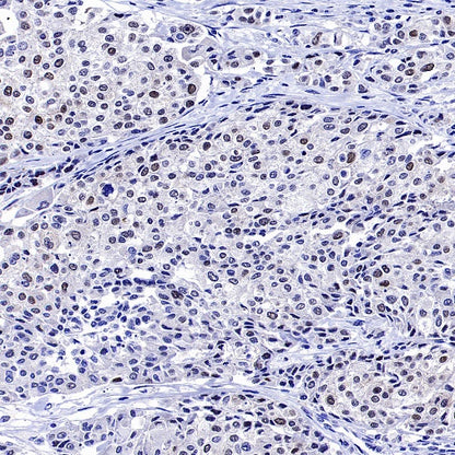 Phospho-NAK/TBK1 (Ser172) Recombinant Rabbit mAb (S-3182)