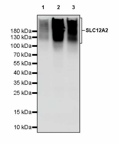 SLC12A2 Recombinant Rabbit mAb (S-2437-30)