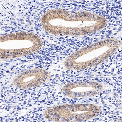 Non-phospho (Active) β-Catenin (Ser37/Thr41) Recombinant Rabbit mAb (S-1813-42)